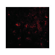 CAPS2 Antibody 100µg