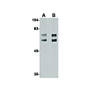 JPH2 Antibody 17 cterm 100µg
