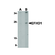 Anti-EFHD1 (RABBIT) Antibody, 100µg, Liquid (sterile filtered)