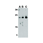 Anti-FABP7 (RABBIT) Antibody, 100µg, Liquid (sterile filtered)