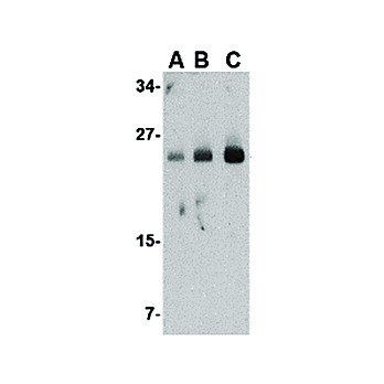 Anti-FABP7 (RABBIT) Antibody, 100µg, Liquid (sterile filtered)