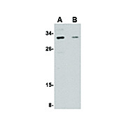 GRTP1 Antibody internal 100µg