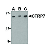 CTRP7 Antibody cterm 100µg