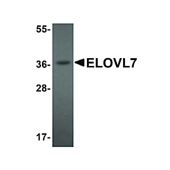 Anti-ELOVL7 (RABBIT) Antibody, 100µg, Liquid (sterile filtered)
