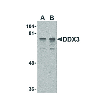 DDX3 Antibody nterm 100µg
