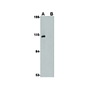 JPH3 Antibody internal 100µg