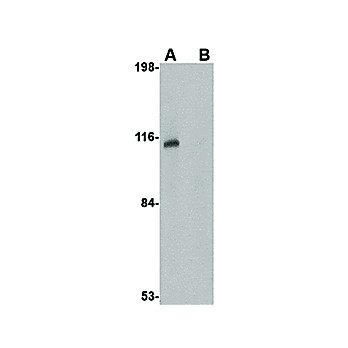 JPH3 Antibody internal 100µg