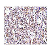 Rb Anti-STIM1 Antibody cterm 100µg