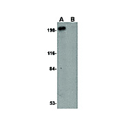 Integrin alpha 4 Antibody cterm 100µg