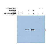 Anti-ATDC Ac-K116 (RABBIT) Antibody, 25µL, Liquid (sterile filtered)