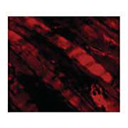 Anti-Emerin (RABBIT) Antibody, 100µg, Liquid (sterile filtered)