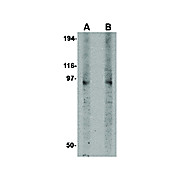 DISC1 Antibody nterm-13 100µg