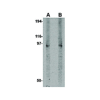 DISC1 Antibody nterm-13 100µg