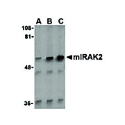 IRAK2 Antibody 100µg