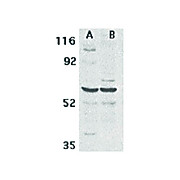 Anti-CARD9 (RABBIT) Antibody, 100µg, Liquid (sterile filtered)