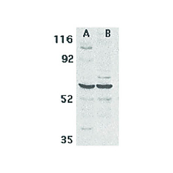 Anti-CARD9 (RABBIT) Antibody, 100µg, Liquid (sterile filtered)