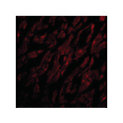 CRTH2 Antibody internal 100µg