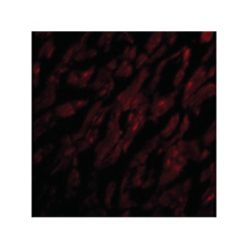 CRTH2 Antibody internal 100µg