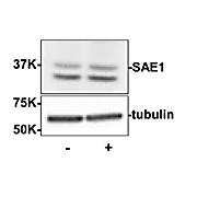 Anti-SUMO Activating Enzyme E1 (SAE1) (Rabbit) Antibody, 100µg, Liquid (sterile filtered)