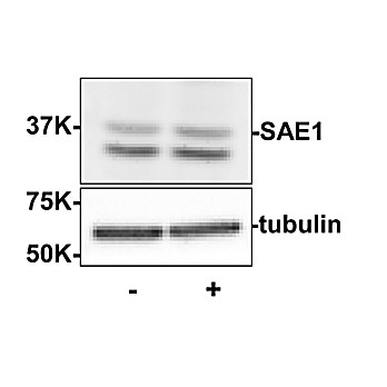 Anti-SUMO Activating Enzyme E1 (SAE1) (Rabbit) Antibody, 100µg, Liquid (sterile filtered)