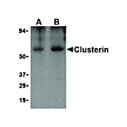 Anti-Clusterin (RABBIT) Antibody, 100µg, Liquid (sterile filtered)