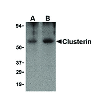Anti-Clusterin (RABBIT) Antibody, 100µg, Liquid (sterile filtered)