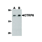 CTRP6 Antibody cterm 100µg