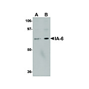 Anti-IA6 (RABBIT) Antibody, 100µg, Liquid (sterile filtered)