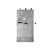 Anti-RNF25 (RABBIT) Antibody, 100µg, Liquid (sterile filtered)