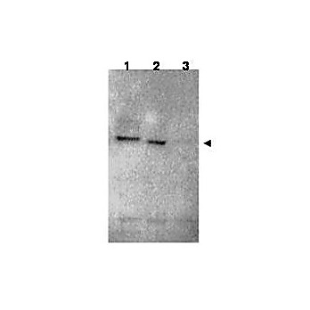 Anti-RNF25 (RABBIT) Antibody, 100µg, Liquid (sterile filtered)