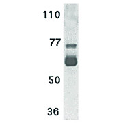 hu Anti-IL-22 Receptor nterm 100µg