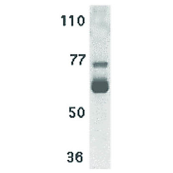 hu Anti-IL-22 Receptor nterm 100µg