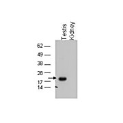 Anti-Glutathione Peroxidase 4 (Gpx4) (RABBIT) Antibody, 100µg, Liquid (sterile filtered)