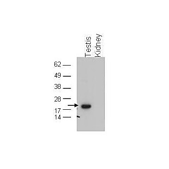 Anti-Glutathione Peroxidase 4 (Gpx4) (RABBIT) Antibody, 100µg, Liquid (sterile filtered)