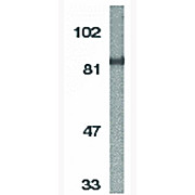 IKK alpha Antibody (19) 100µg