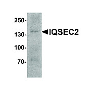 IQSEC2 Antibody 100µg