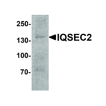 IQSEC2 Antibody 100µg
