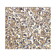 IRAK-M Antibody 100µg