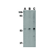 IPR1 Antibody cterm 100µg