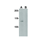 GPVI Antibody internal 100µg