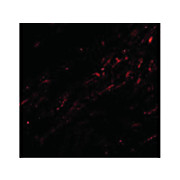 CIDE-A Antibody 100µg