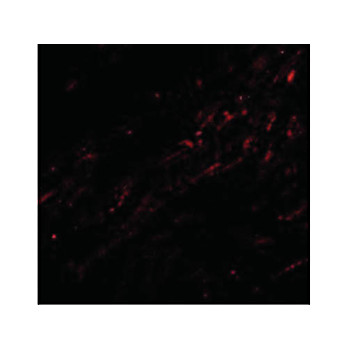 CIDE-A Antibody 100µg