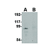 JPH4 Antibody internal 100µg