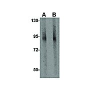 GLE1 Antibody cterm 100µg