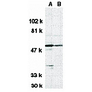 Anti-DRAK1 (RABBIT) Antibody, 100µg, Liquid (sterile filtered)