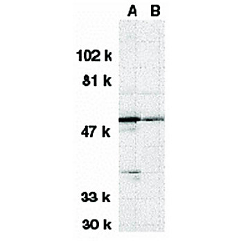 Anti-DRAK1 (RABBIT) Antibody, 100µg, Liquid (sterile filtered)