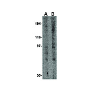 GRIK3 Antibody 100µg