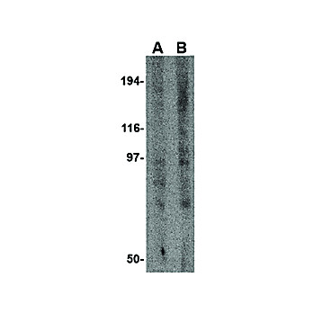 GRIK3 Antibody 100µg