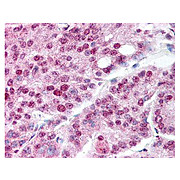 Anti-Heat Shock Protein HSP 90-alpha acetyl specific K294 (RABBIT) Antibody, 100µg, Liquid (sterile filtered)