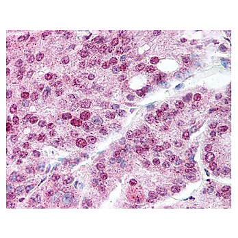 Anti-Heat Shock Protein HSP 90-alpha acetyl specific K294 (RABBIT) Antibody, 100µg, Liquid (sterile filtered)